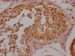 IHC image of CSB-PA884445NA01HU diluted at 1:200 and staining in paraffin-embedded human testis tissue performed on a Leica BondTM system. After dewaxing and hydration, antigen retrieval was mediated by high pressure in a citrate buffer (pH 6.0). Section was blocked with 10% normal goat serum 30min at RT. Then primary antibody (1% BSA) was incubated at 4°C overnight. The primary is detected by a Goat anti-rabbit polymer IgG labeled by HRP and visualized using 0.05% DAB.