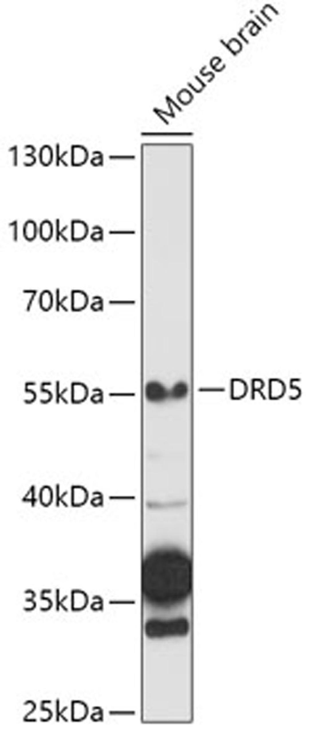 Western blot - DRD5 antibody (A1719)