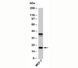 Western blot testing of human samples with AGR2 antibody at 5ug/ml.