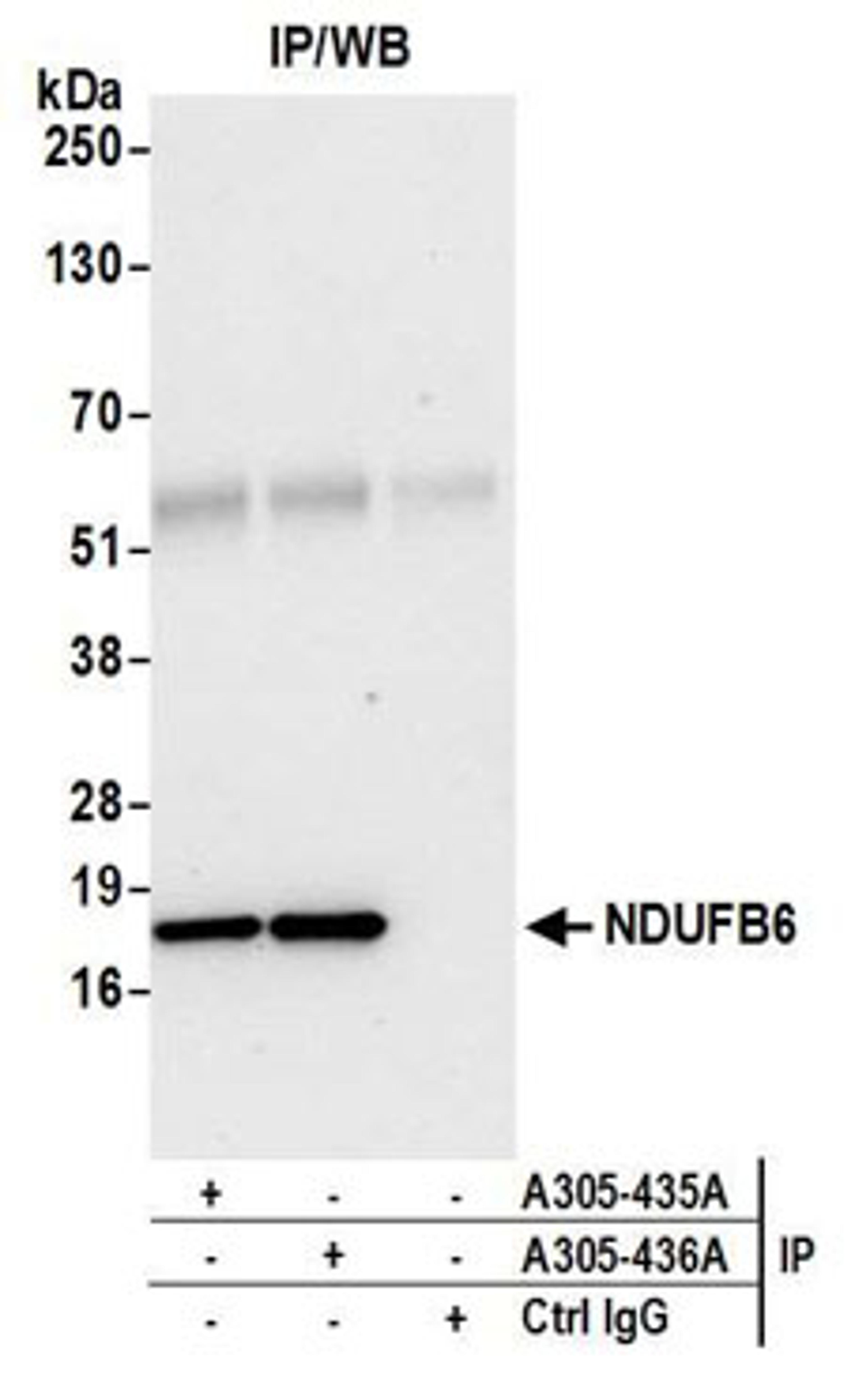 Detection of human NDUFB6 by western blot of immunoprecipitates.