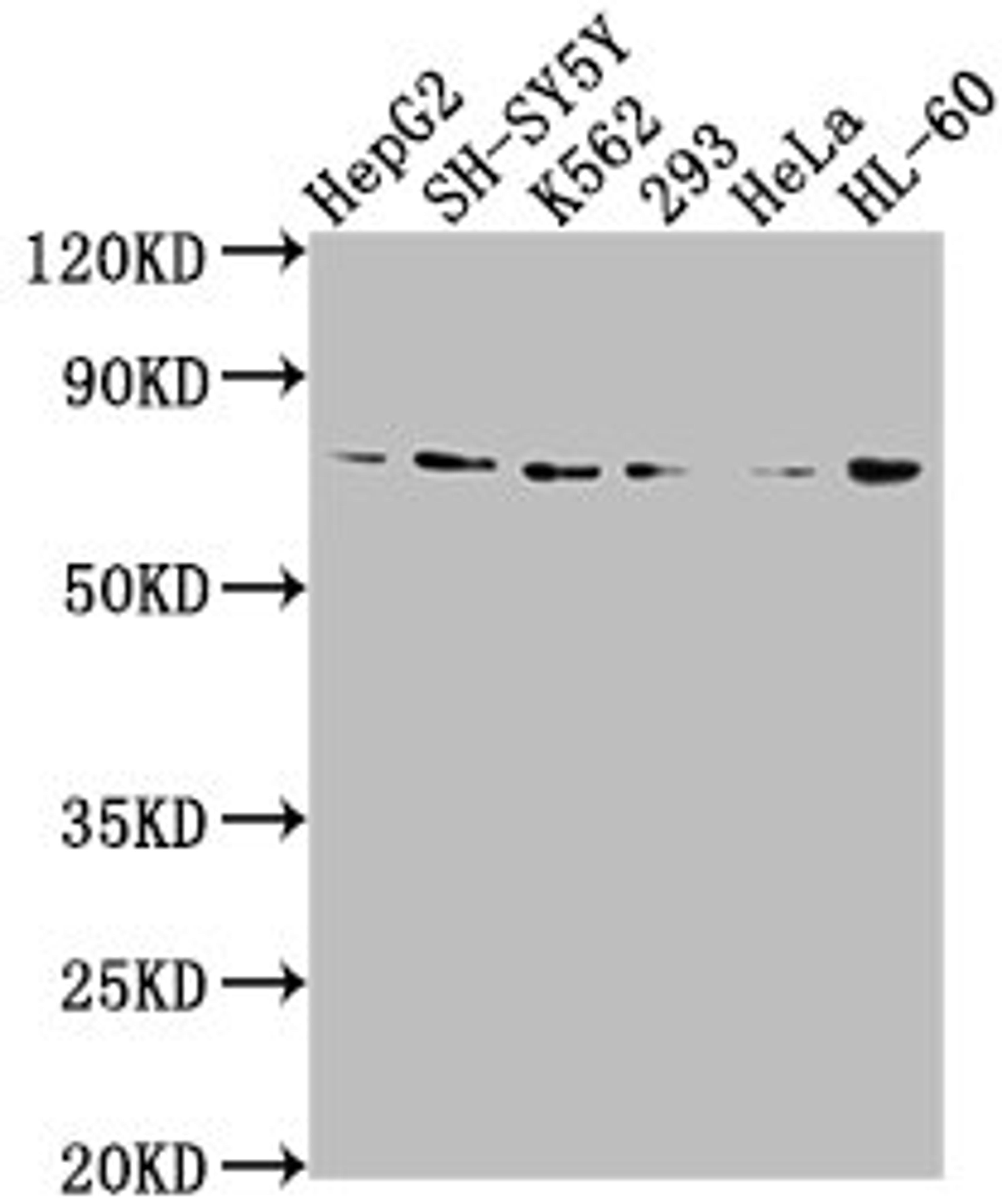 Western Blot. Positive WB detected in: HepG2 whole cell lysate, SH-SY5Y whole cell lysate, K562 whole cell lysate, 293 whole cell lysate, Hela whole cell lysate, HL60 whole cell lysate. All lanes: VASN antibody at 1:2000. Secondary. Goat polyclonal to rabbit IgG at 1/50000 dilution. Predicted band size: 72 kDa. Observed band size: 72 kDa