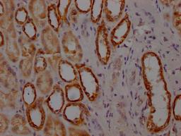 IHC image of CSB-RA978157A0HU diluted at 1:100 and staining in paraffin-embedded human kidney tissue performed on a Leica BondTM system. After dewaxing and hydration, antigen retrieval was mediated by high pressure in a citrate buffer (pH 6.0). Section was blocked with 10% normal goat serum 30min at RT. Then primary antibody (1% BSA) was incubated at 4℃ overnight. The primary is detected by a Goat anti-rabbit IgG polymer labeled by HRP and visualized using 0.05% DAB.