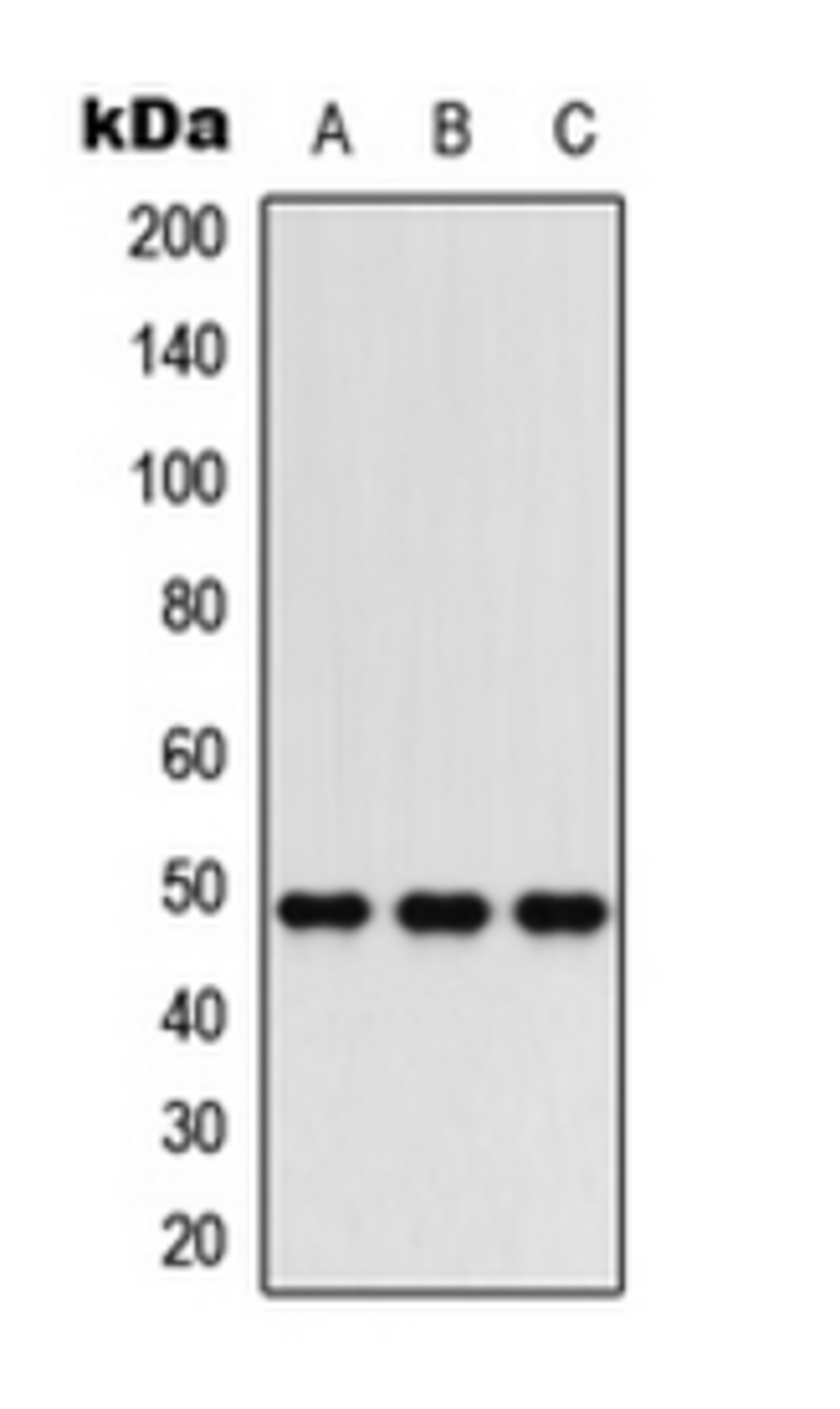 Western blot analysis of HepG2 (Lane 1), mouse brain (Lane 2), rat heart (Lane 3) whole cell lysates using C5AR1 antibody