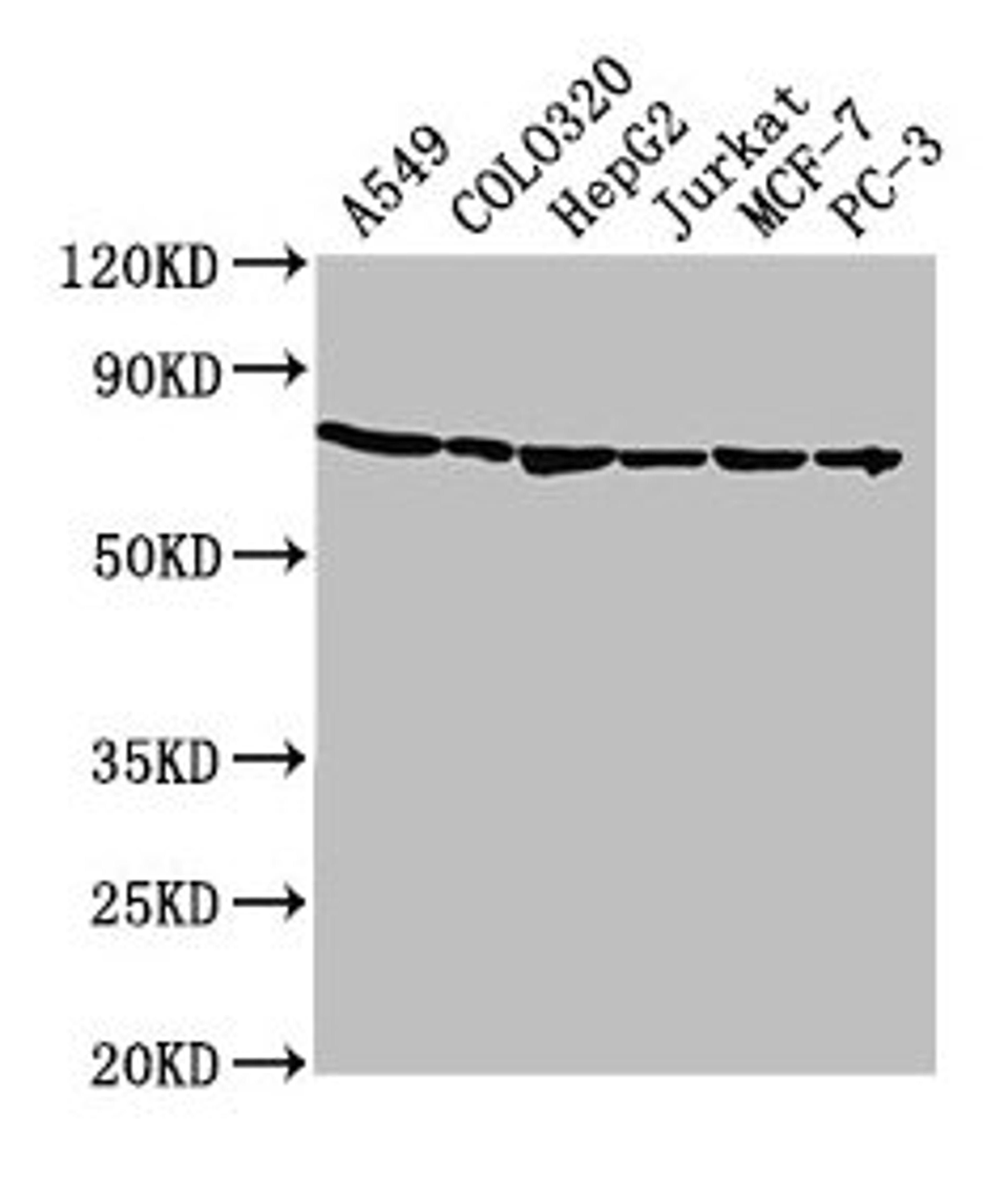 Western Blot. Positive WB detected in: A549 whole cell lysate, COLO320 whole cell lysate, HepG2 whole cell lysate, Jurkat whole cell lysate, MCF-7 whole cell lysate, PC-3 whole cell lysate. All lanes: HSPA1A antibody at 1:2000. Secondary. Goat polyclonal to rabbit IgG at 1/50000 dilution. Predicted band size: 71, 64 kDa. Observed band size: 71 kDa. 