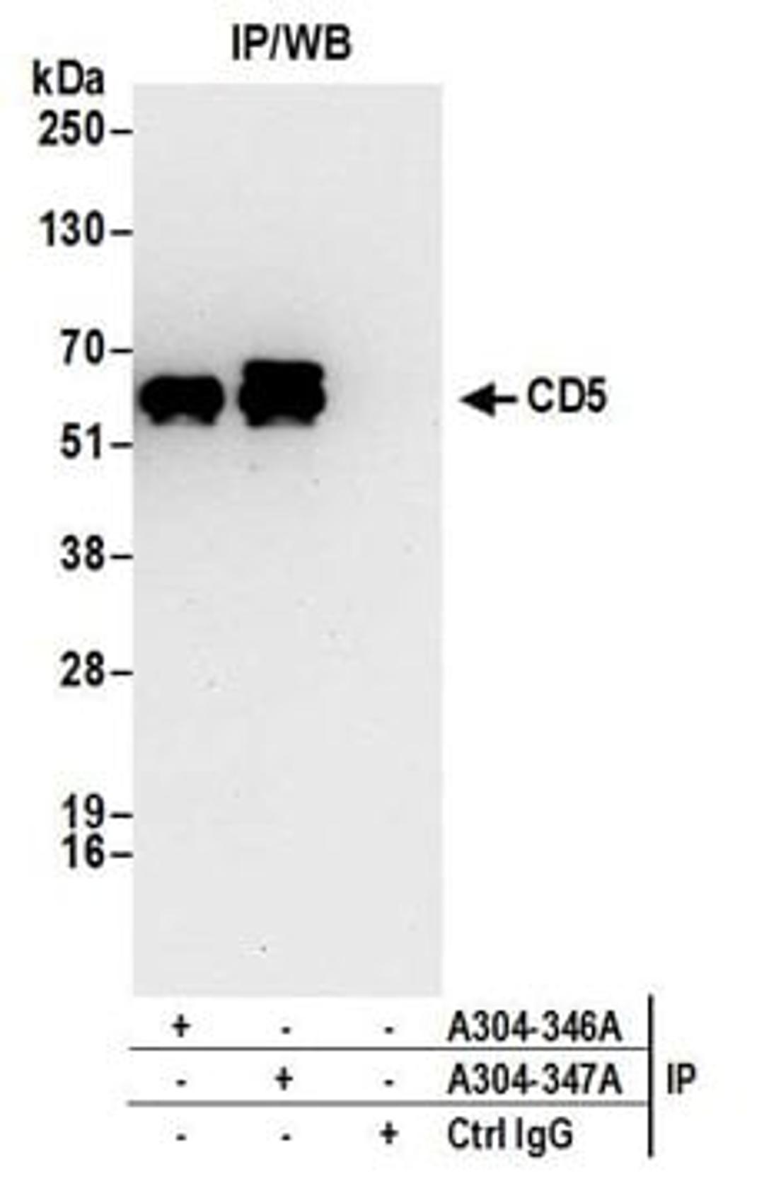 Detection of human CD5 by western blot of immunoprecipitates.