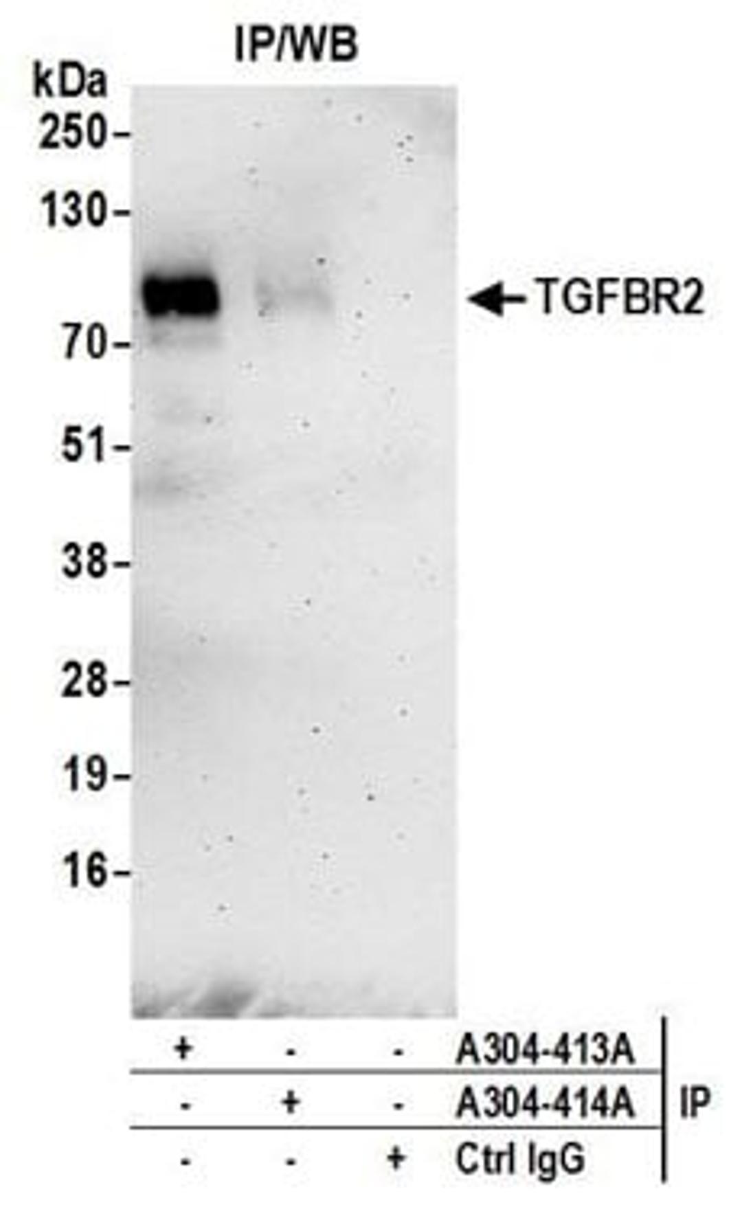 Detection of human TGFBR2 by western blot of immunoprecipitates.