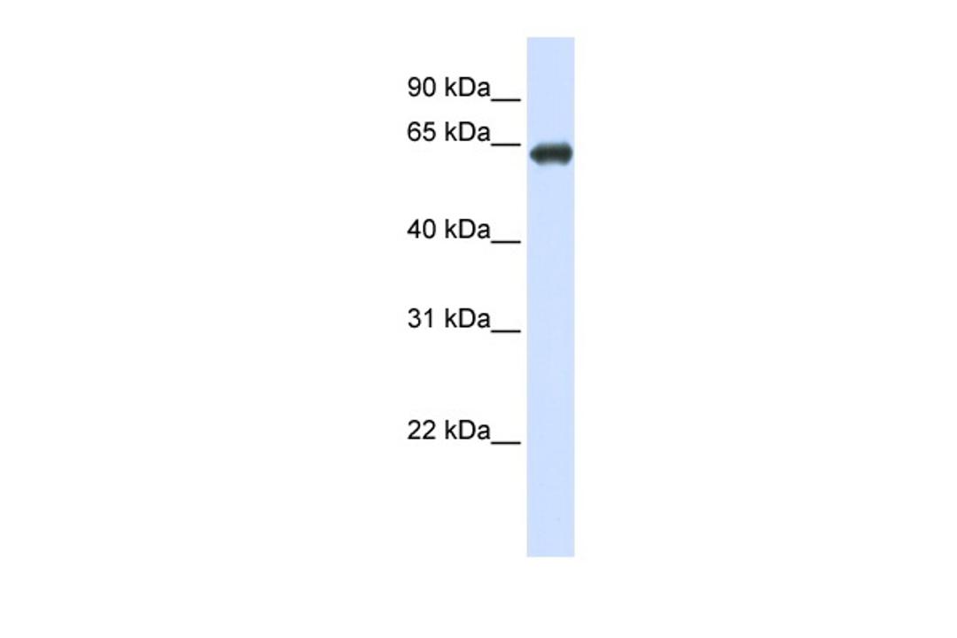 Antibody used in WB on Transfected 293T at 0.2-1 ug/ml.