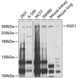 Western blot - NSD1 antibody (A9981)