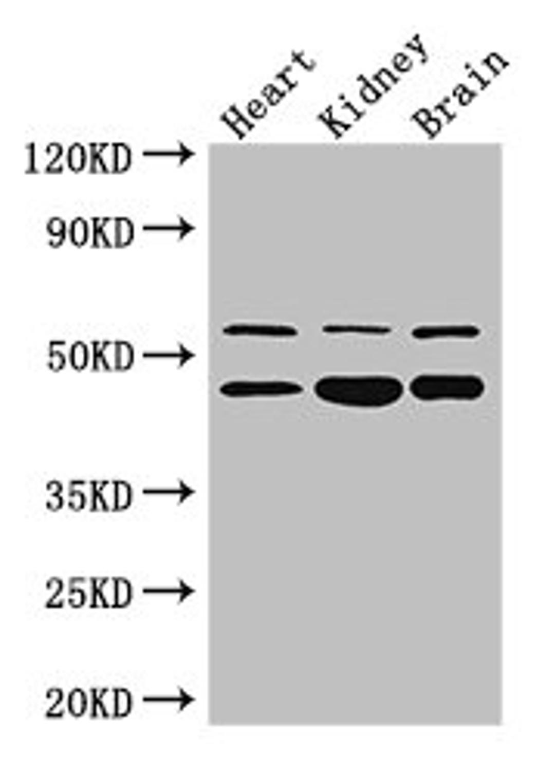 Western Blot. Positive WB detected in: Mouse heart tissue, , Mouse kidney tissue, Mouse brain tissue. All lanes: HNF4A antibody at 3ug/ml. Secondary. Goat polyclonal to rabbit IgG at 1/50000 dilution. Predicted band size: 53, 52, 47, 57, 51, 49, 44 kDa. Observed band size: 53, 47 kDa. 