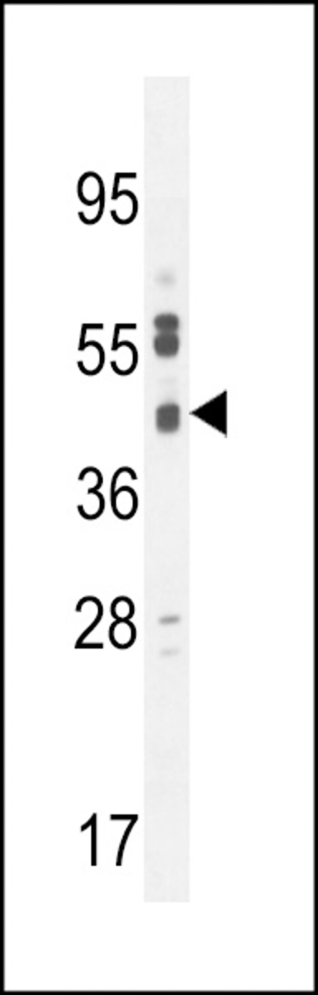 Western blot analysis in U251 cell line lysates (35ug/lane).