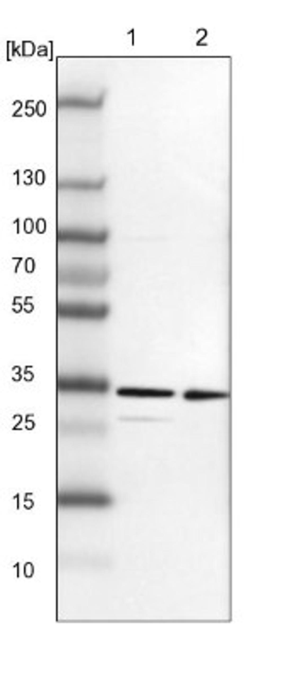 Western Blot: TXNDC9 Antibody [NBP1-89052] - Lane 1: NIH-3T3 cell lysate (Mouse embryonic fibroblast cells)<br/>Lane 2: NBT-II cell lysate (Rat Wistar bladder tumour cells)