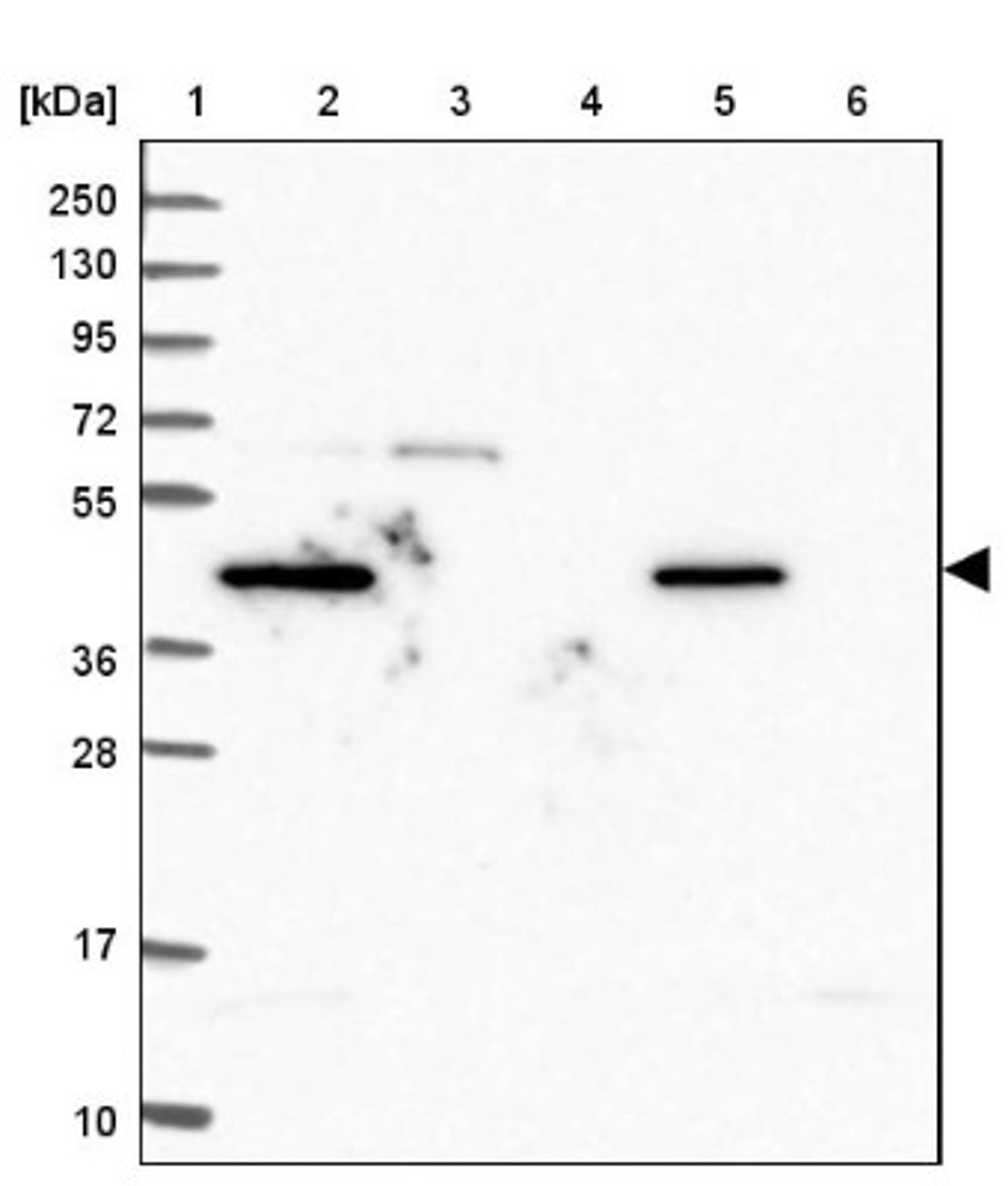 Western Blot: Zinc finger protein 639 Antibody [NBP2-47571] - Lane 1: Marker [kDa] 250, 130, 95, 72, 55, 36, 28, 17, 10.  Lane 2: Human cell line RT-4.  Lane 3: Human cell line U-251MG.  Lane 4: Human plasma (IgG/HSA depleted).  Lane 5: Human liver tissue.  Lane 6: Human tonsil tissue.