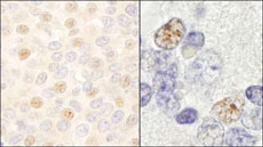 Detection of human and mouse DDX46 by immunohistochemistry.