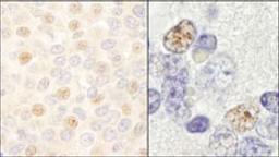 Detection of human and mouse DDX46 by immunohistochemistry.