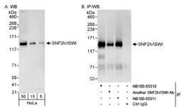 Western Blot: SNF2H Antibody [NB100-55310] - Detection of Human SNF2h/ISWI on HeLa whole cell lysate using NB100-55310. SNF2h/ISWI was also immunoprecipitated by rabbit anti-SNF2h/ISWI antibodies BL4495 and NB100-55311.