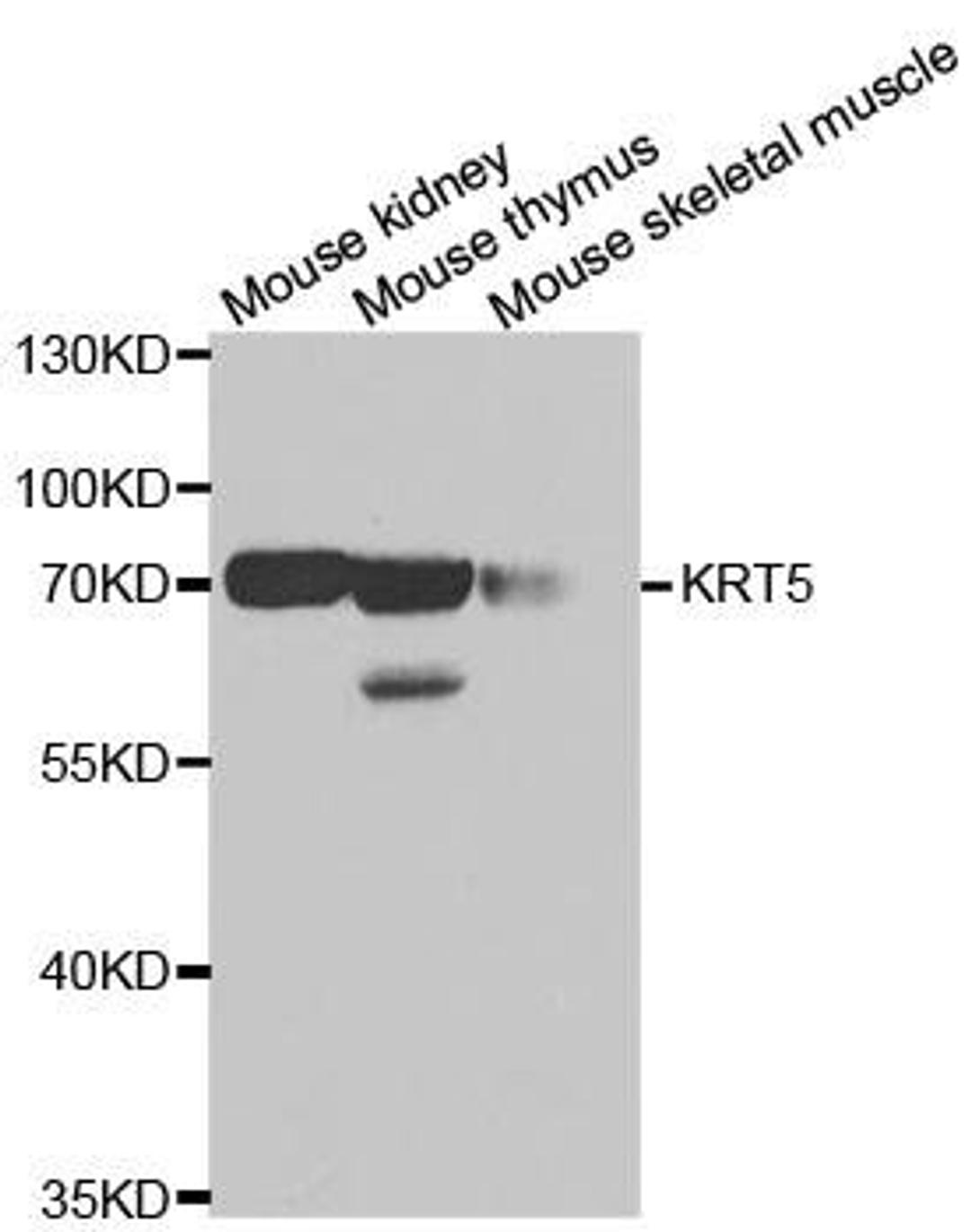 Western blot analysis of extracts of various cell lines using KRT5 antibody