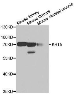 Western blot analysis of extracts of various cell lines using KRT5 antibody