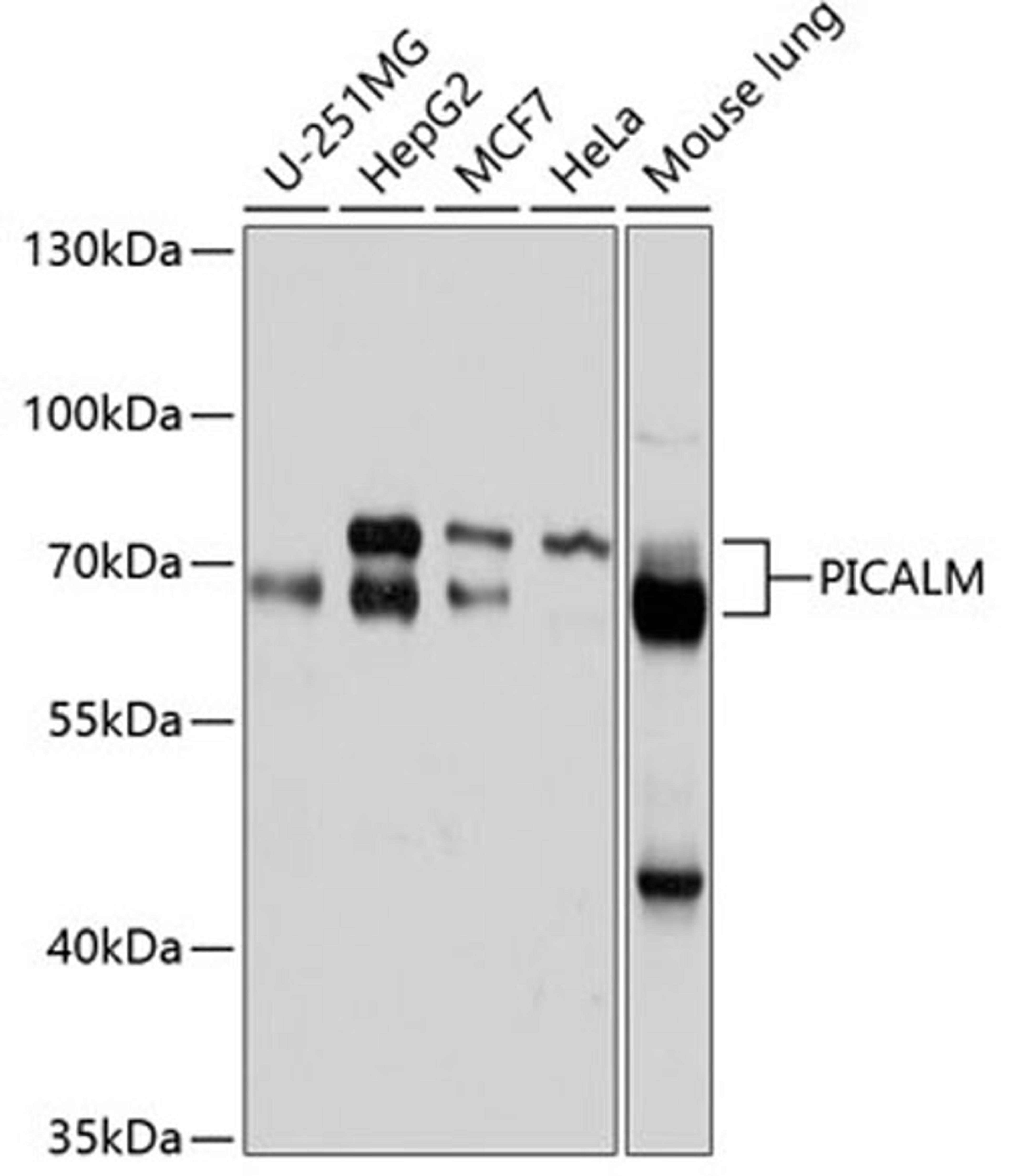 Western blot - PICALM antibody (A10575)