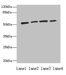 Western blot. All lanes: ETNK1 antibody at 0.5µg/ml. Lane 1: A549 whole cell lysate. Lane 2: A431 whole cell lysate. Lane 3: HepG2 whole cell lysate. Lane 4: MCF-7 whole cell lysate. Secondary. Goat polyclonal to rabbit IgG at 1/10000 dilution. Predicted band size: 51, 28 kDa. Observed band size: 51 kDa