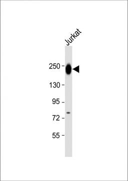 Western Blot at 1:1000 dilution + Jurkat whole cell lysate Lysates/proteins at 20 ug per lane.