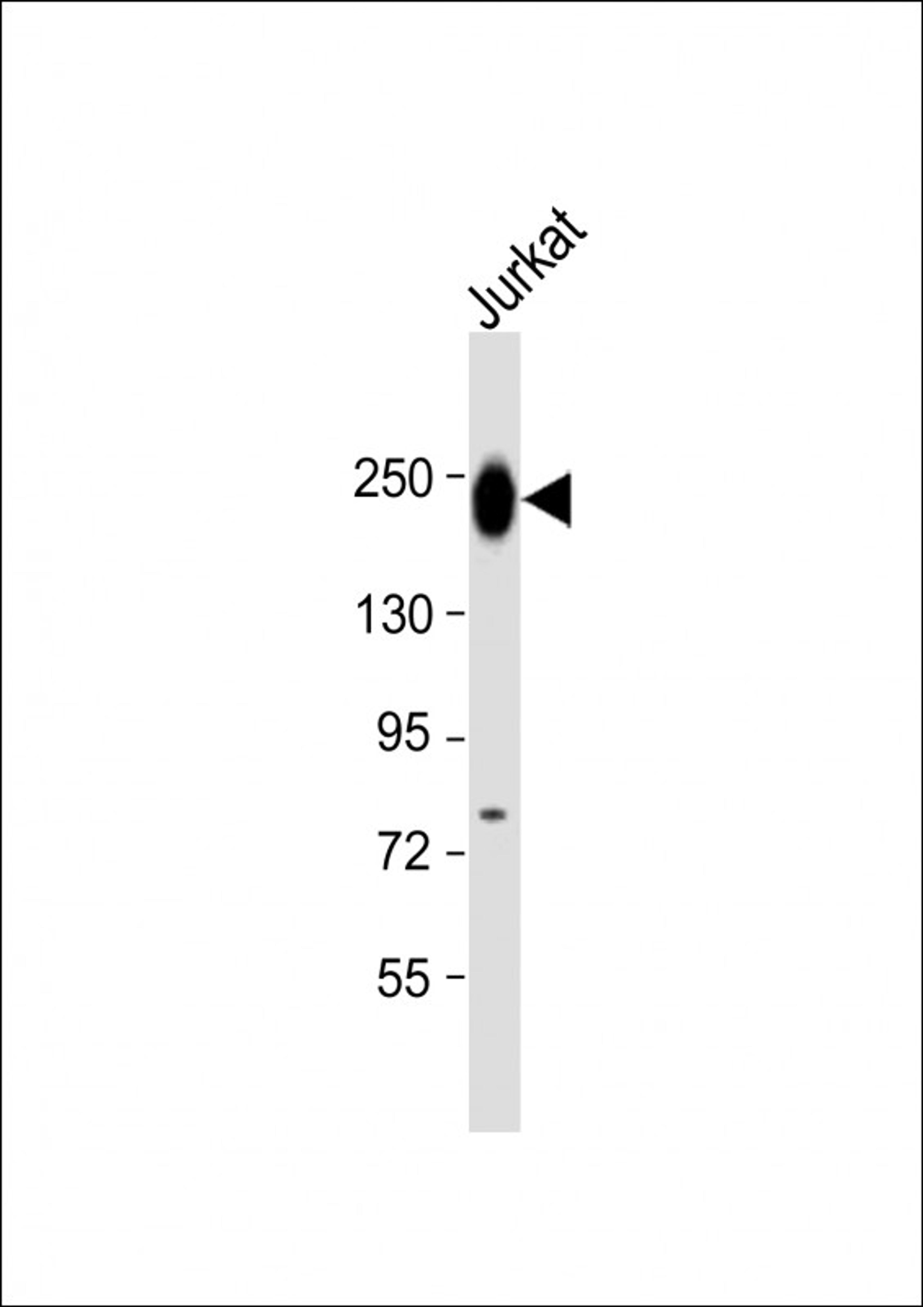 Western Blot at 1:1000 dilution + Jurkat whole cell lysate Lysates/proteins at 20 ug per lane.