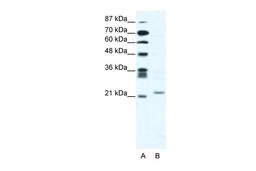 Antibody used in WB on Human Jurkat 2.5 ug/ml.