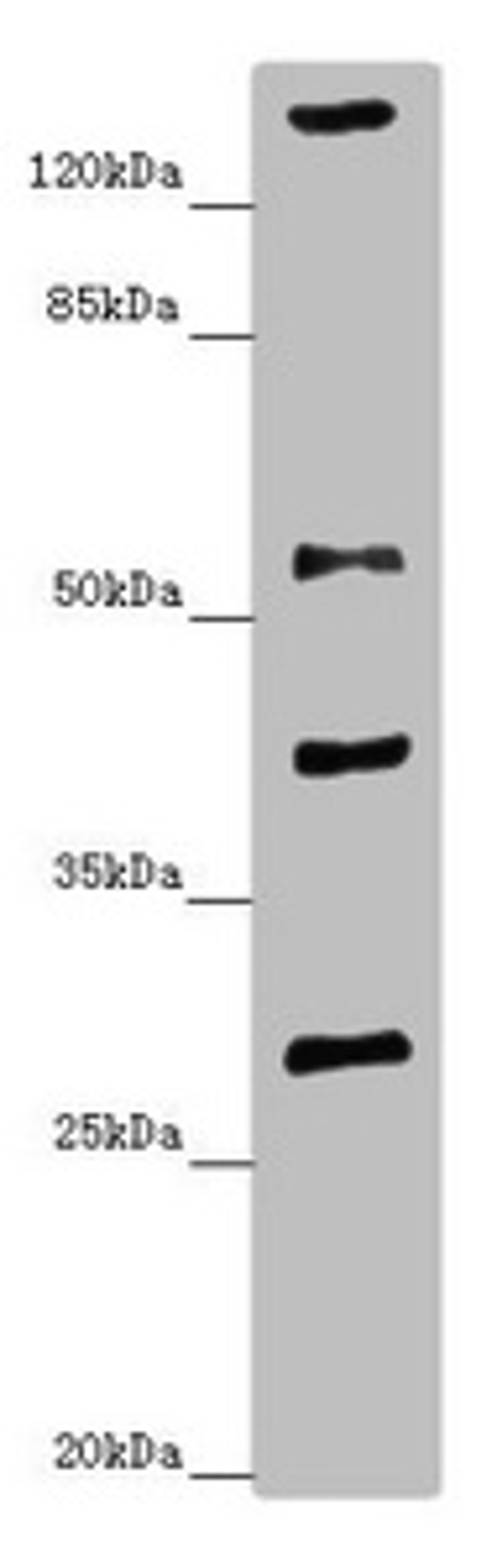 Western blot. All lanes: ZSCAN26antibody at 1.34ug/ml + Mouse brain tissue. Secondary. Goat polyclonal to rabbit IgG at 1/10000 dilution. Predicted band size: 56, 38 kDa. Observed band size: 56, 29, 40, 160 kDa.
