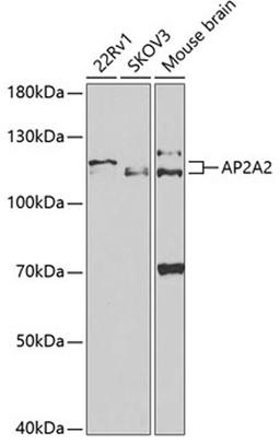 Western blot - AP2A2 antibody (A5391)