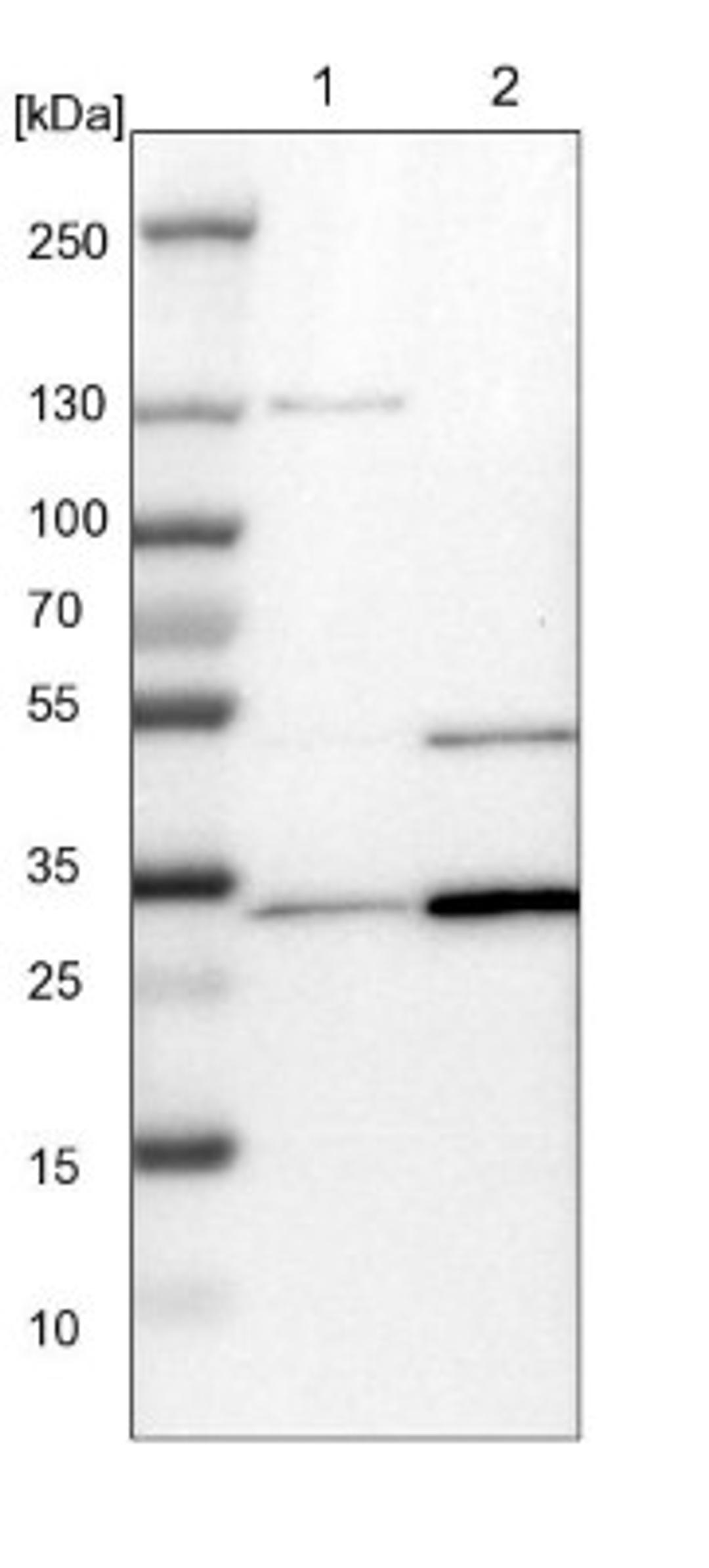 Western Blot: tropomyosin-3 Antibody [NBP1-87382] - Lane 1: NIH-3T3 cell lysate (Mouse embryonic fibroblast cells)<br/>Lane 2: NBT-II cell lysate (Rat Wistar bladder tumour cells)