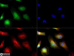 Immunocytochemistry/Immunofluorescence: ATOX1 Antibody [NBP1-06611] - ATOX1 antibody was tested in HeLa cells with Dylight 488 (green). Nuclei and alpha-tubulin were counterstained with DAPI (blue) and Dylight 550 (red).