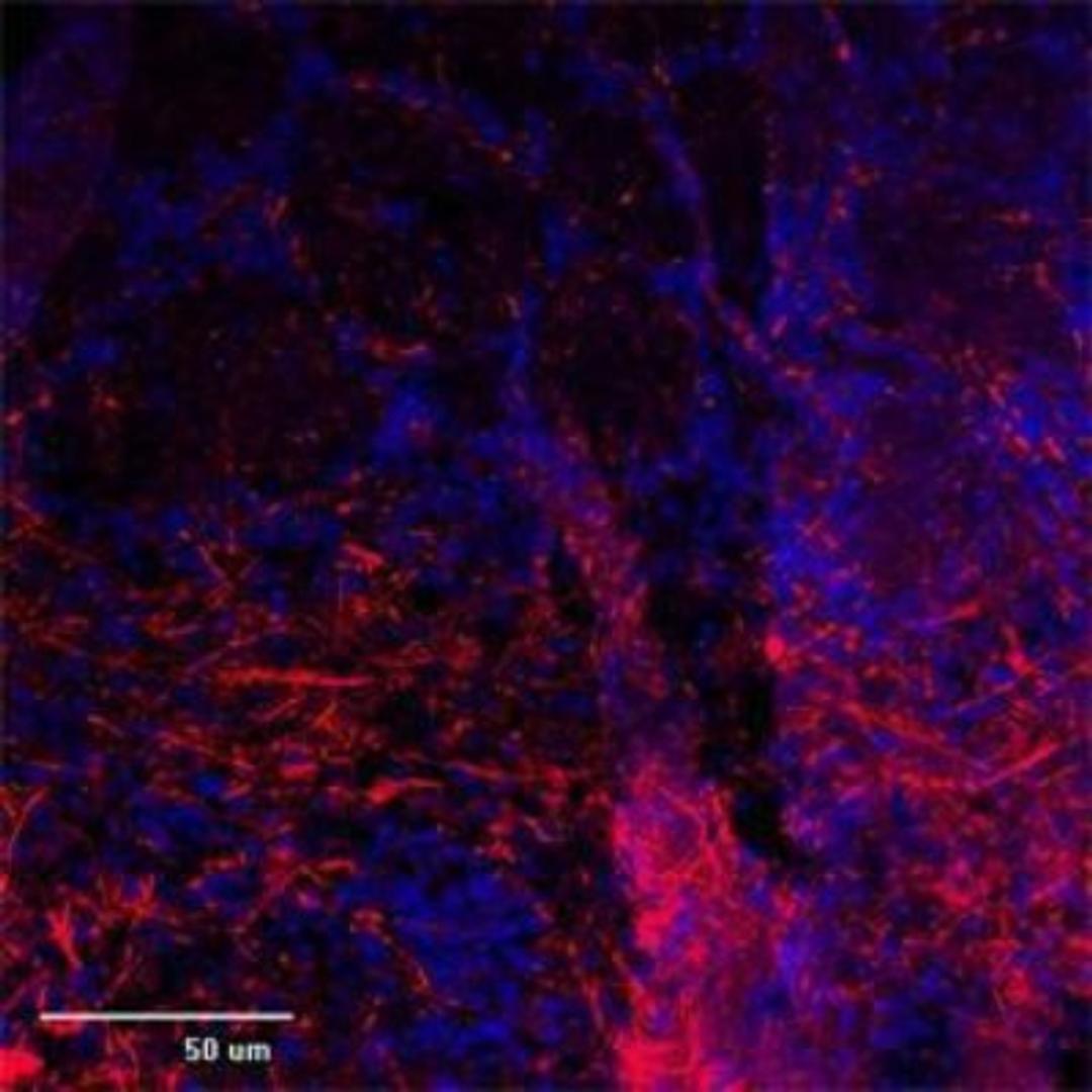 Immunocytochemistry/Immunofluorescence: TRP1 Antibody [NB100-98844] - IF (confocal) on rat brain at 1:500 dilution using Rabbit antibody to 2d extracellular loop of TRPC1: whole serum, DAPI counterstained appearing in blue.