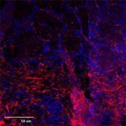 Immunocytochemistry/Immunofluorescence: TRP1 Antibody [NB100-98844] - IF (confocal) on rat brain at 1:500 dilution using Rabbit antibody to 2d extracellular loop of TRPC1: whole serum, DAPI counterstained appearing in blue.