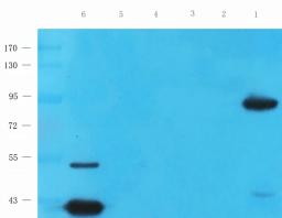 Western blot analysis of rat heart (lane 1), mouse skeletal muscle (lane 2), rat testis (lane 3), mouse colon (lane 4), rat thymus (lane 5), mouse liver (lane 6) tissue using anti-PGC1 alpha antibody (0.5 ug/ml)