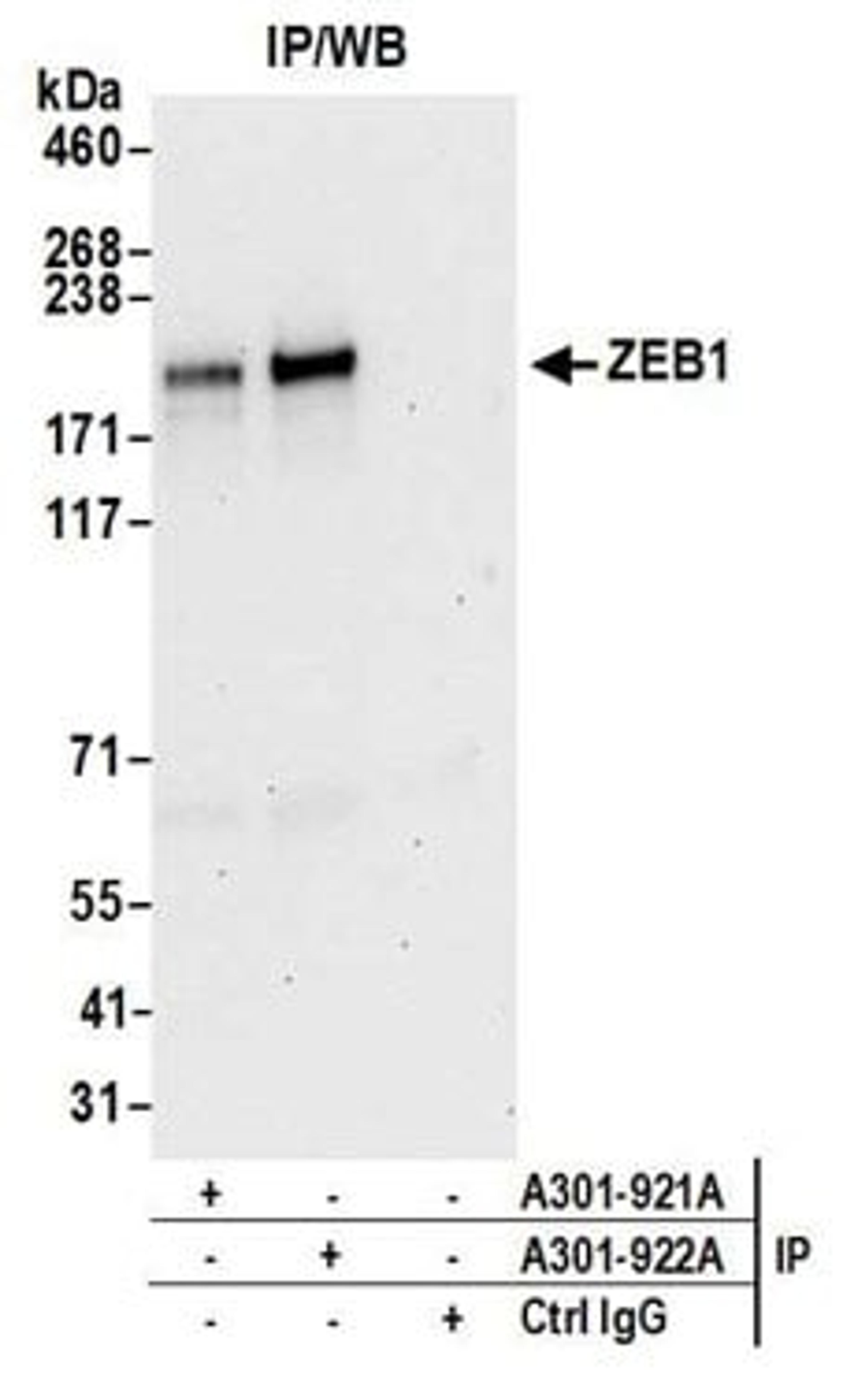 Detection of human ZEB1 by western blot of immunoprecipitates.