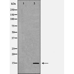 Western blot analysis of HeLa cell line and H3 protein expressed in E.coli using Histone H3K4me2 antibody