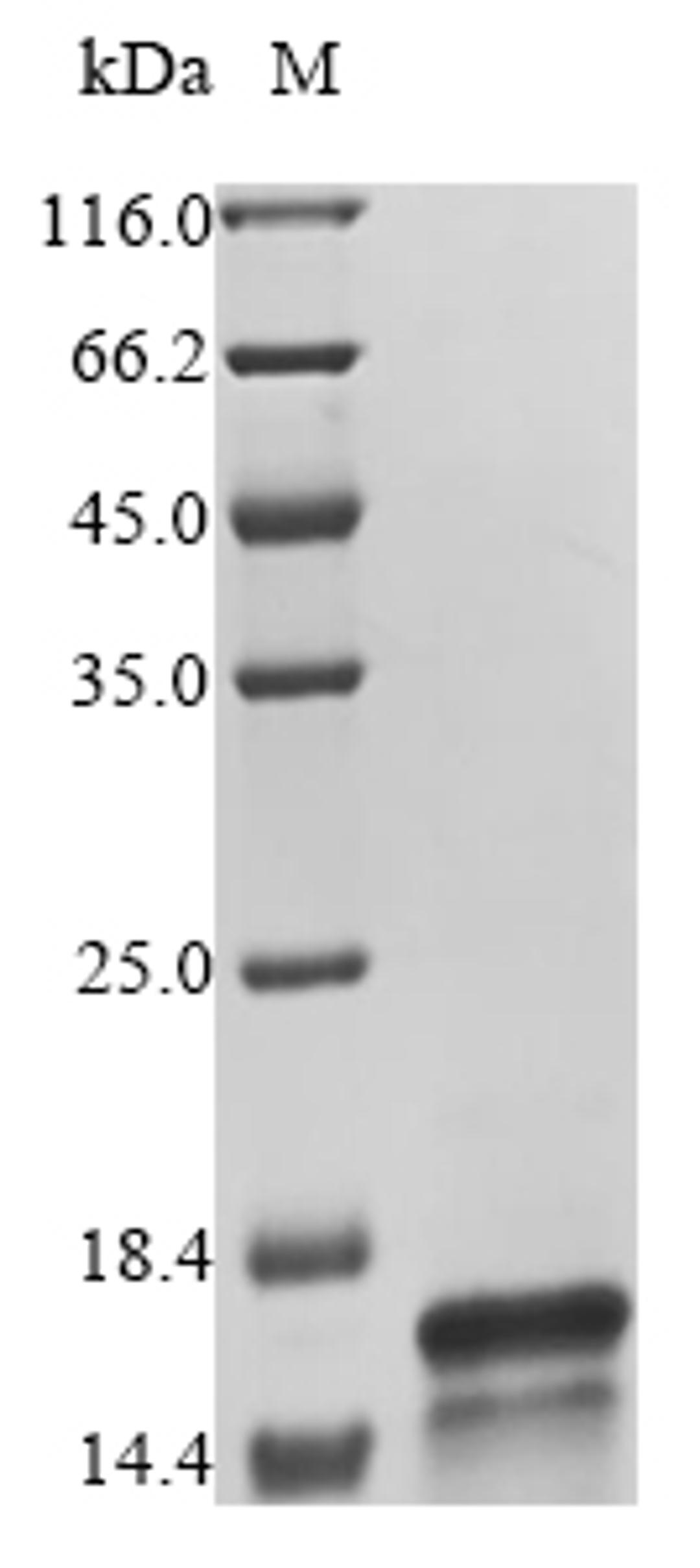 (Tris-Glycine gel) Discontinuous SDS-PAGE (reduced) with 5% enrichment gel and 15% separation gel.
