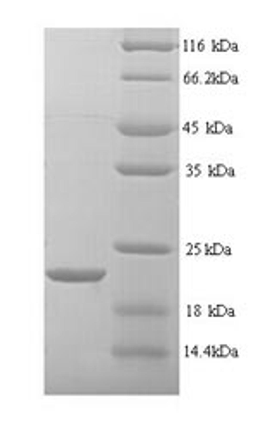 (Tris-Glycine gel) Discontinuous SDS-PAGE (reduced) with 5% enrichment gel and 15% separation gel.