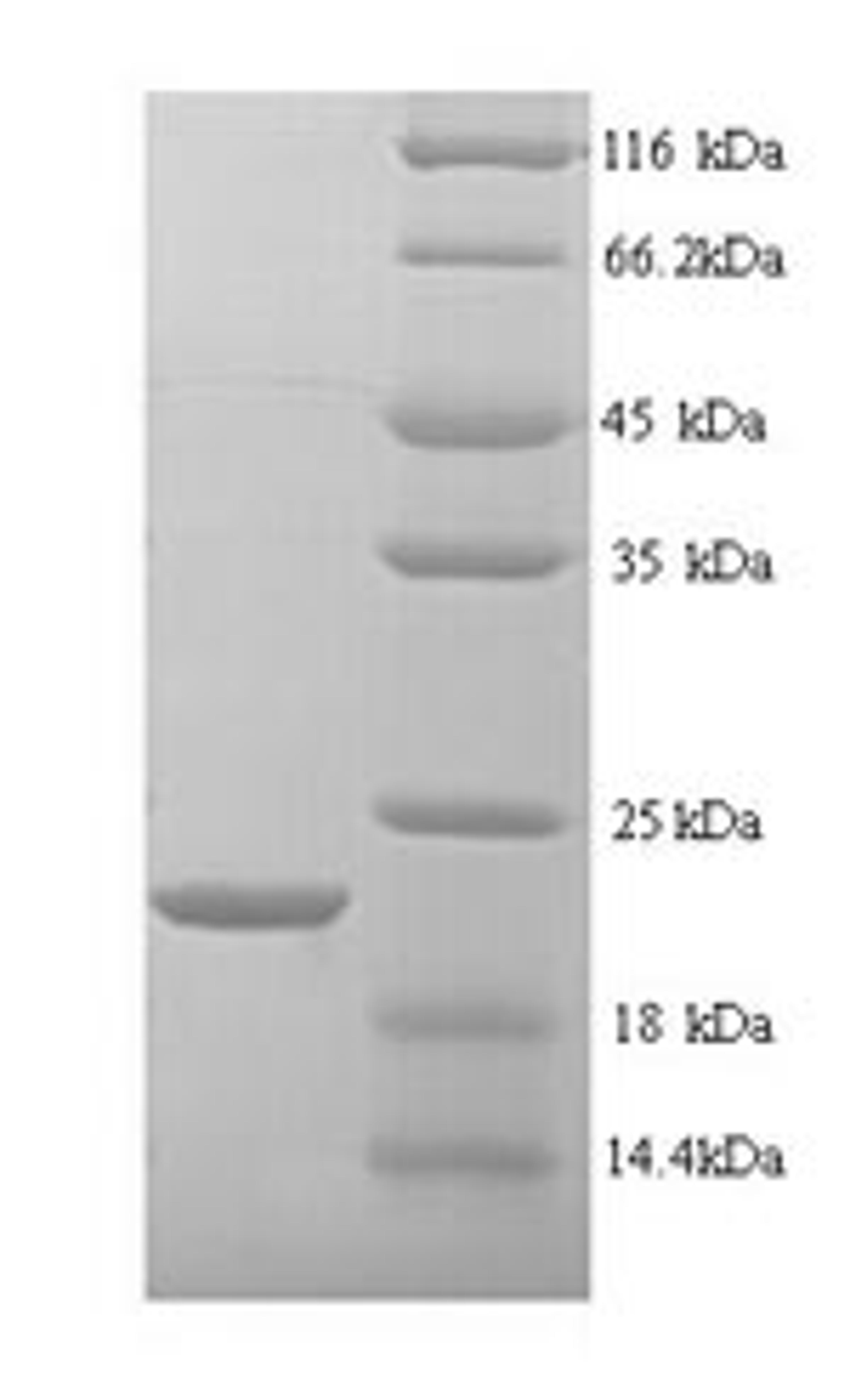 (Tris-Glycine gel) Discontinuous SDS-PAGE (reduced) with 5% enrichment gel and 15% separation gel.