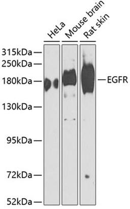 Western blot - EGFR antibody (A2069)