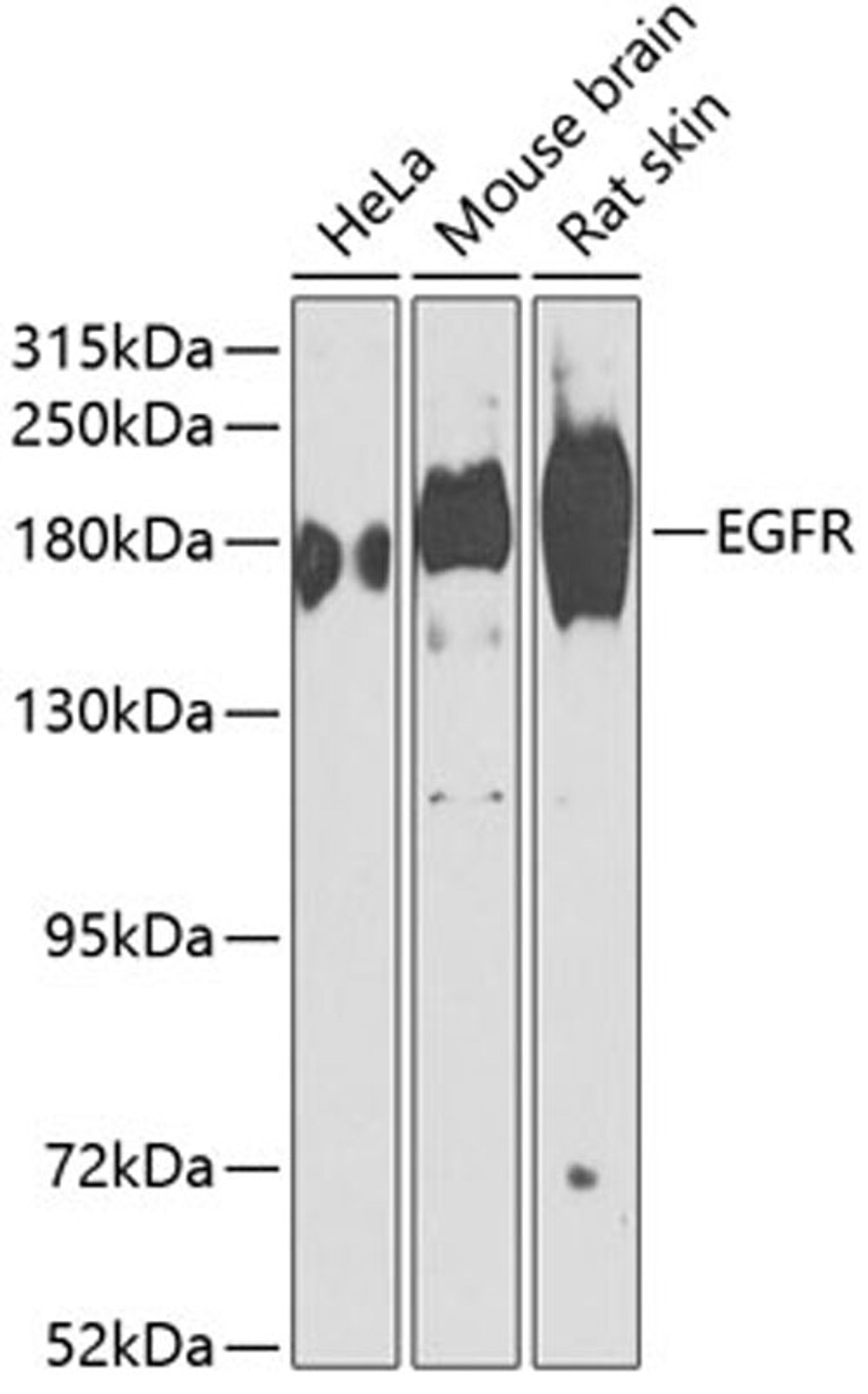 Western blot - EGFR antibody (A2069)