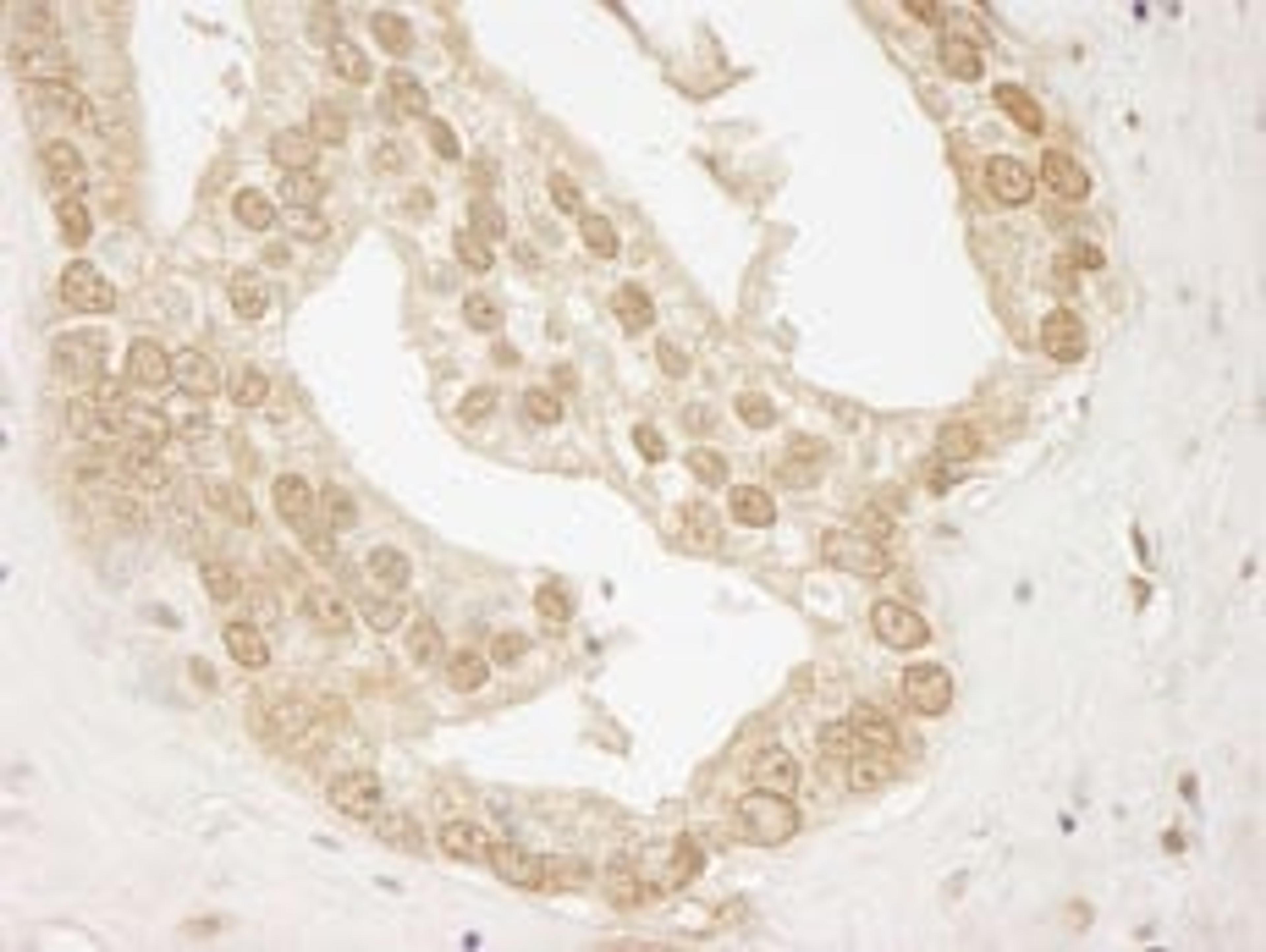 Detection of human AKT1 by immunohistochemistry.