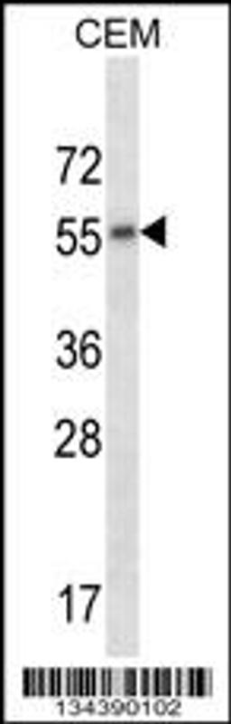 Western blot analysis in CEM cell line lysates (35ug/lane).