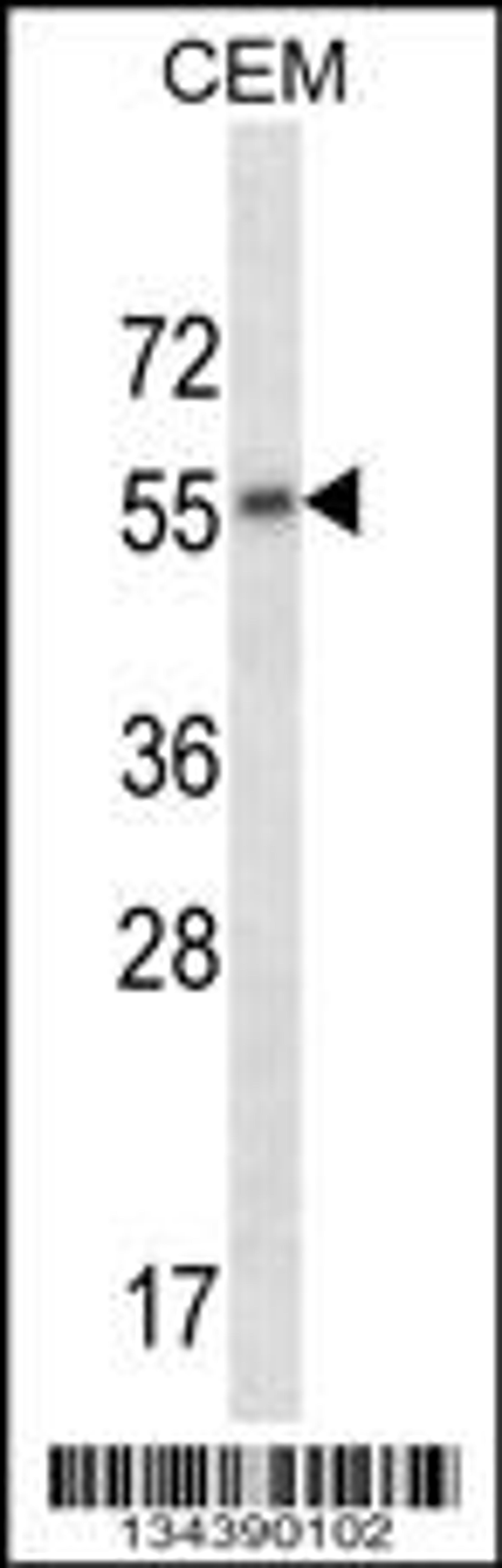 Western blot analysis in CEM cell line lysates (35ug/lane).