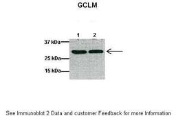 Antibody used in WB on Mouse heart at: 1:1000 (Lane 1: 40ug mouse heart lysate, Lane 2: 40ug mouse heart lysate).