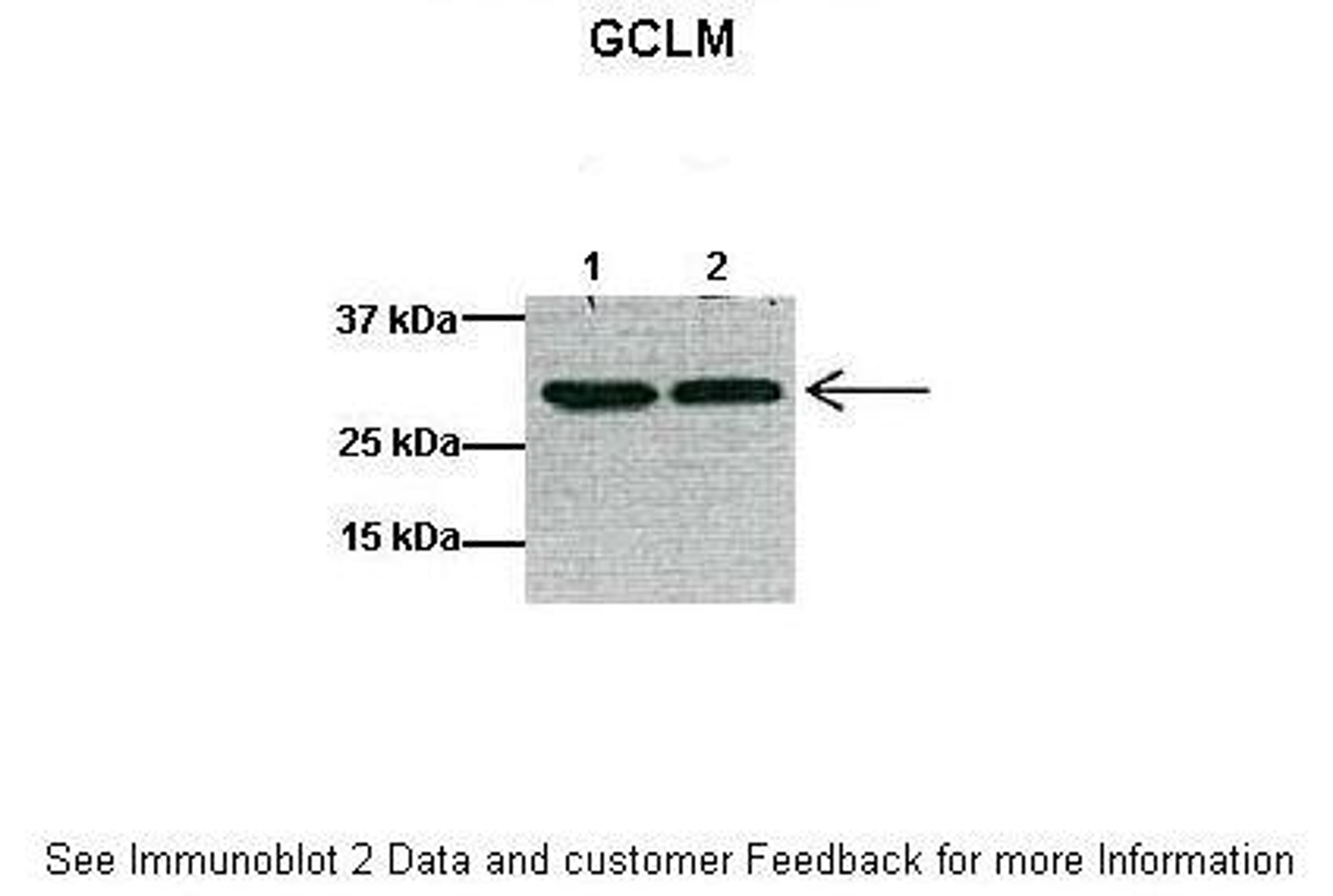 Antibody used in WB on Mouse heart at: 1:1000 (Lane 1: 40ug mouse heart lysate, Lane 2: 40ug mouse heart lysate).