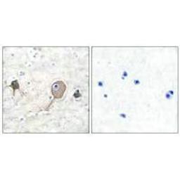 Immunohistochemical analysis of paraffin-embedded human brain tissue using NSE antibody.