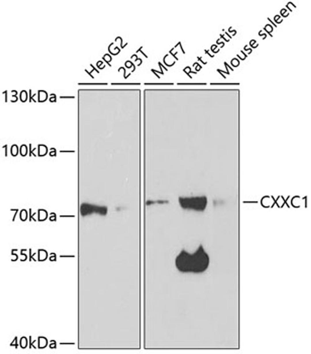 Western blot - CXXC1 antibody (A5814)