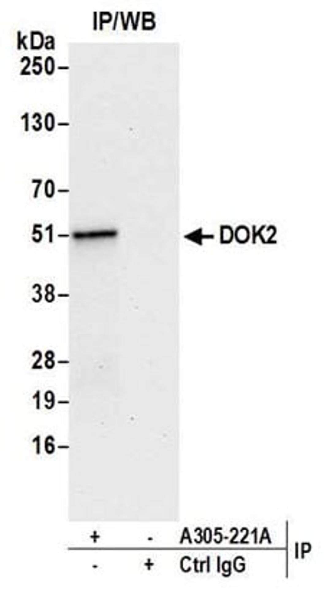 Detection of human DOK2 by western blot of immunoprecipitates.