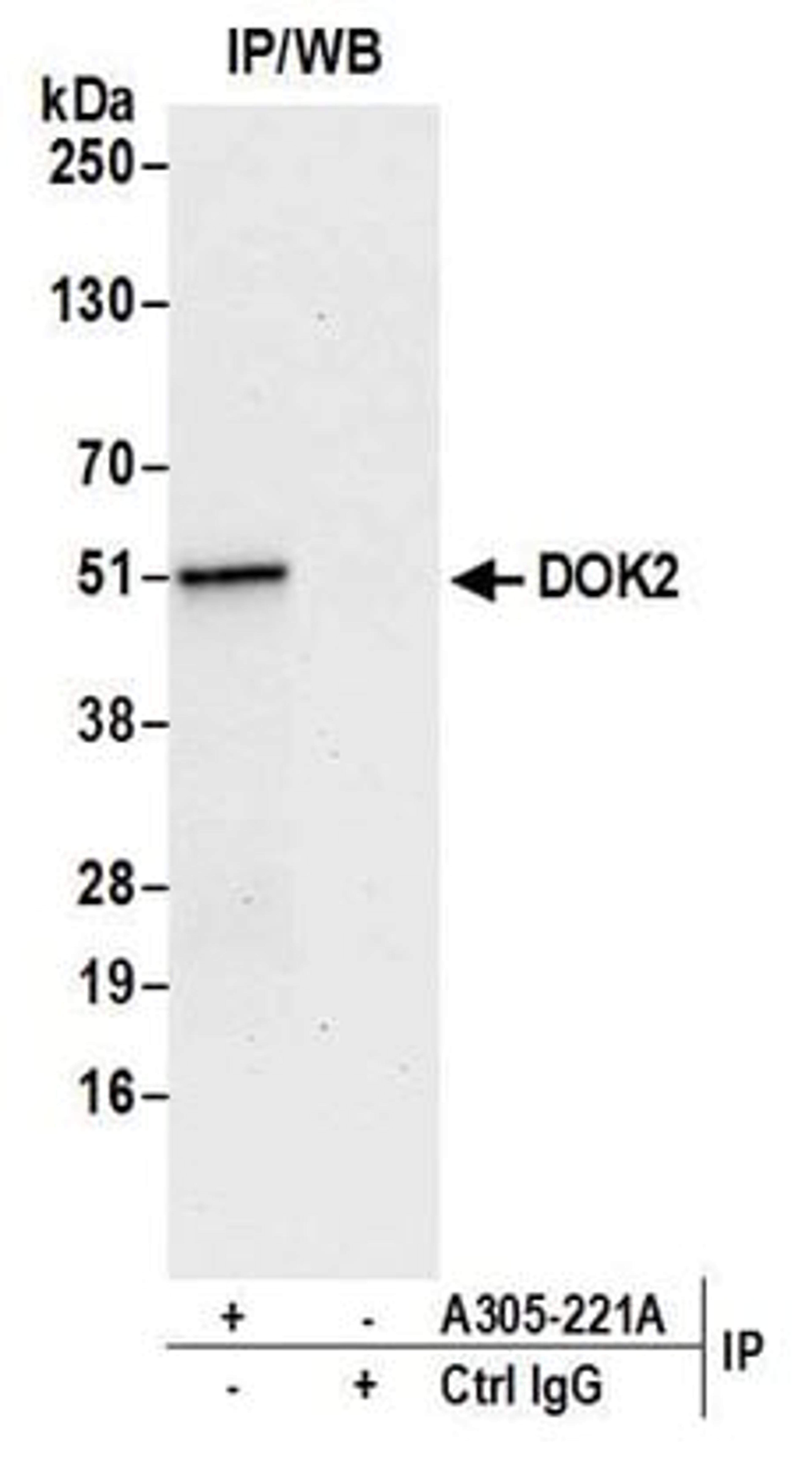 Detection of human DOK2 by western blot of immunoprecipitates.