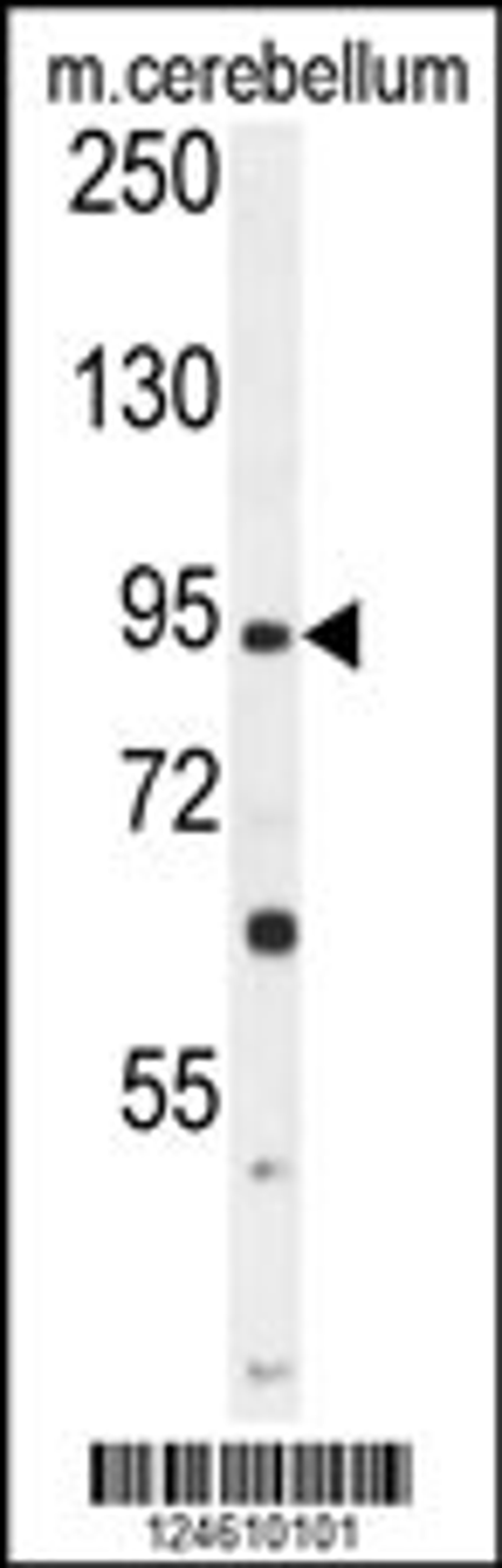 Western blot analysis in mouse cerebellum tissue lysates (35ug/lane).